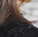 Dandruff