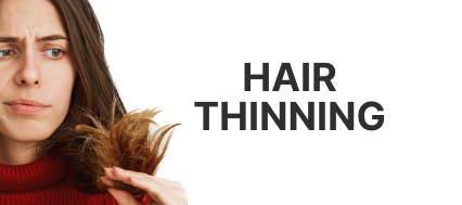 image for hair thinning
