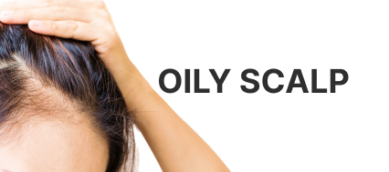image for oily scalp